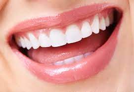 Revitalize Your Smile with Dental Veneers in Islamabad: An In-Depth Exploration